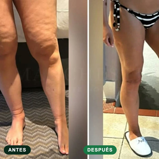 Transformación Drenaya