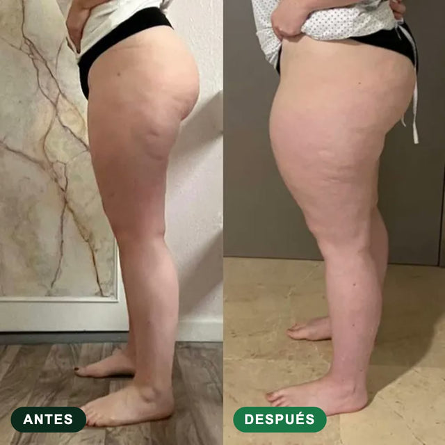 Transformación Drenaya