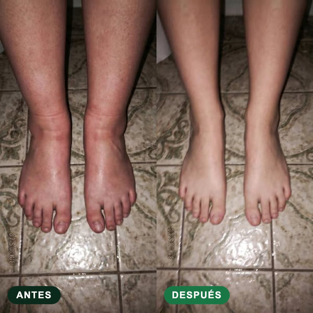 Transformación Drenaya